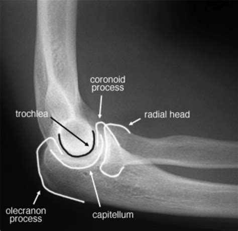 ramble elbow trite *** olate quizlet|Flashcards, learning tools and textbook solutions .